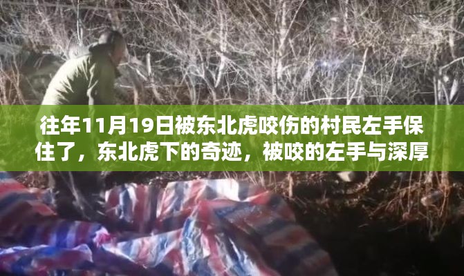 东北虎咬人奇迹背后的故事，左手重生与深厚友情的见证