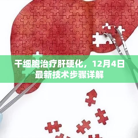 干细胞治疗肝硬化，最新技术步骤详解（12月4日版）